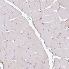 Immunohistochemical staining of human skeletal muscle shows no positivity in myocytes as expected.