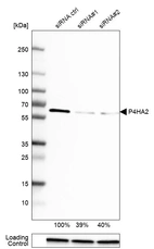 Western blot analysis in U-251MG cells transfected with control siRNA, target specific siRNA probe #1 and #2, using Anti-P4HA2 antibody. Remaining relative intensity is presented. Loading control: Anti-GAPDH.