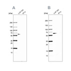 Western blot analysis using Anti-P4HA2 antibody HPA016997 (A) shows similar pattern to independent antibody HPA027824 (B).