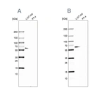 Western blot analysis using Anti-P4HA2 antibody HPA016997 (A) shows similar pattern to independent antibody HPA027824 (B).