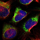 Immunofluorescent staining of human cell line U-2 OS shows localization to endoplasmic reticulum & vesicles.