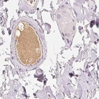 Immunohistochemical staining of human colon using Anti-AFM antibody HPA017006.