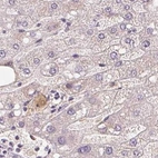 Immunohistochemical staining of human liver using Anti-AFM antibody HPA017006.