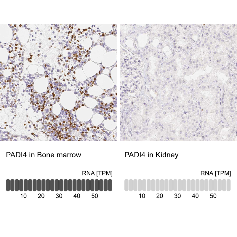 Anti-PADI4 Antibody