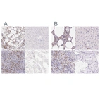Immunohistochemical staining of human bone marrow, liver, spleen and testis using Anti-PADI4 antibody HPA017007 (A) shows similar protein distribution across tissues to independent antibody HPA042825 (B).