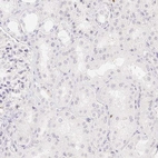 Immunohistochemical staining of human kidney shows no nuclear positivity as expected.