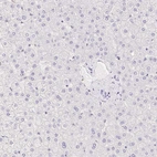 Immunohistochemical staining of human liver shows no nuclear positivity in hepatocytes as expected.
