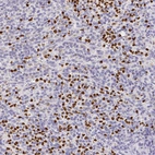 Immunohistochemical staining of human spleen shows strong nuclear positivity in cells in red pulp.
