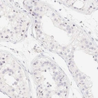 Immunohistochemical staining of human testis shows no nuclear positivity in cells in seminiferous ducts as expected.