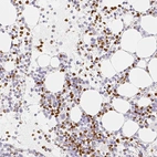 Immunohistochemical staining of human bone marrow shows strong nuclear positivity in hematopoietic cells.