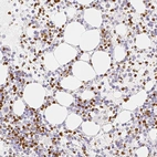 Immunohistochemical staining of human bone marrow shows strong nuclear positivity in hematopoietic cells.