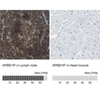 Anti-APBB1IP Antibody