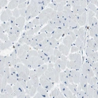 Immunohistochemical staining of human heart muscle shows no positivity in cardiomyocytes as expected.