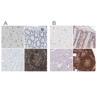 Immunohistochemical staining of human cerebral cortex, colon, heart muscle and lymph node using Anti-APBB1IP antibody HPA017009 (A) shows similar protein distribution across tissues to independent antibody HPA063903 (B).