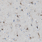 Immunohistochemical staining of human cerebral cortex shows strong cytoplasmic positivity in glial cells.