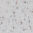 Immunohistochemical staining of human cerebral cortex shows strong cytoplasmic positivity in glial cells.