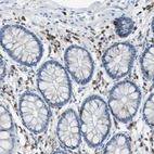 Immunohistochemical staining of human colon shows strong cytoplasmic positivity in lymphoid cells.