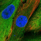 Immunofluorescent staining of human cell line BJ shows localization to plasma membrane & cytosol.