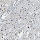 Anti-PDLIM1 Antibody