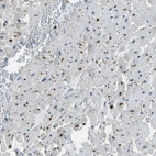Anti-PDLIM1 Antibody