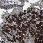 Immunohistochemical staining of human Placenta shows strong cytoplasmic positivity in decidual cells.