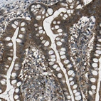 Immunohistochemical staining of human Small intestine shows moderate cytoplasmic positivity in glandular cells.
