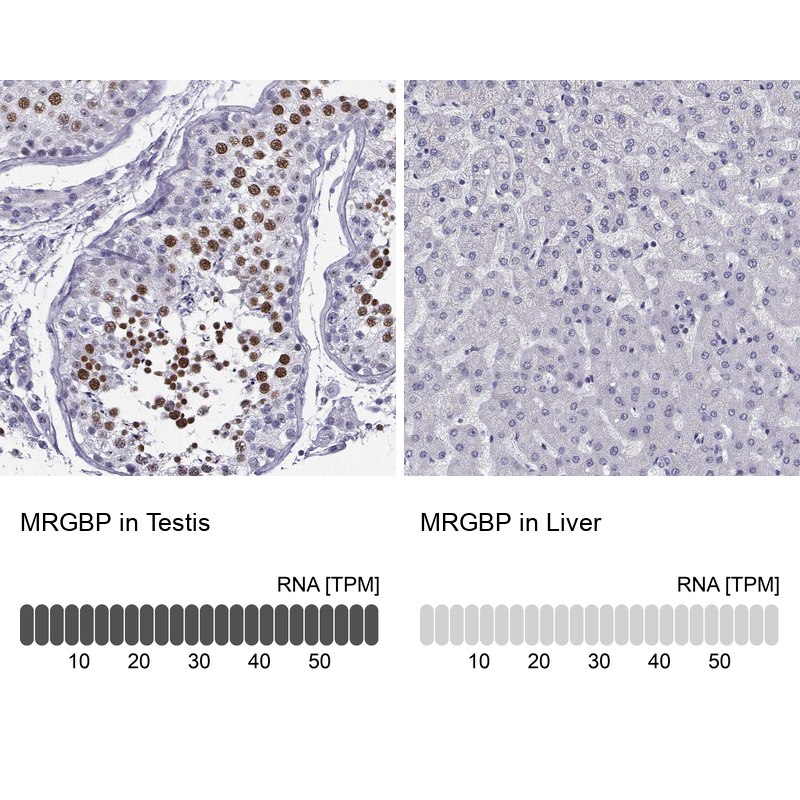 Anti-MRGBP Antibody