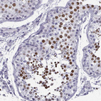 Immunohistochemical staining of human Testis shows strong nuclear positivity in cells in seminiferous ducts.