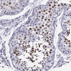 Immunohistochemical staining of human Testis shows strong nuclear positivity in cells in seminiferous ducts.