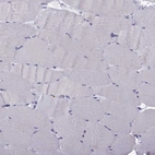 Immunohistochemical staining of human Skeletal muscle shows very weak nuclear positivity in myocytes.