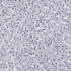 Immunohistochemical staining of human Liver shows very weak nuclear positivity in hepatocytes.