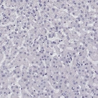 Immunohistochemical staining of human Liver shows very weak nuclear positivity in hepatocytes.