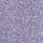 Immunohistochemical staining of human Pancreas shows very weak nuclear positivity in exocrine glandular cells.