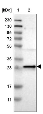 Lane 1: Marker [kDa] 230, 130, 95, 72, 56, 36, 28, 17, 11_br/_Lane 2: Human cell line RT-4