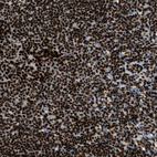 Immunohistochemical staining of human lymph node shows strong nuclear positivity in non-germinal center cells.