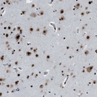 Immunohistochemical staining of human cerebral cortex shows strong nuclear positivity in neurons.