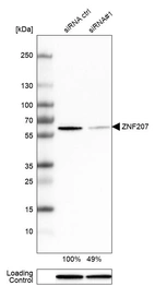 Western blot analysis in HEK293 cells transfected with control siRNA, target specific siRNA probe #1, using Anti-ZNF207 antibody. Remaining relative intensity is presented. Loading control: Anti-GAPDH.