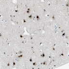Immunohistochemical staining of human Cerebral cortex shows strong nuclear positivity in neuronal and glial cells.