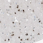Immunohistochemical staining of human Cerebral cortex shows strong nuclear positivity in neuronal and glial cells.