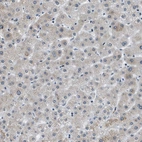 Immunohistochemical staining of human Liver shows very weak nuclear positivity in hepatocytes.