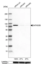 Western blot analysis in SK-BR-3 cells transfected with control siRNA, target specific siRNA probe #1 and #2, using Anti-GATAD2B antibody. Remaining relative intensity is presented. Loading control: Anti-GAPDH.