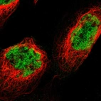 Immunofluorescent staining of human cell line A-431 shows localization to nucleoplasm.