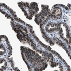 Anti-LTA4H Antibody