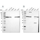 Western blot analysis using Anti-LTA4H antibody HPA017017 (A) shows similar pattern to independent antibody HPA008399 (B).