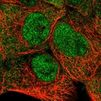 Immunofluorescent staining of human cell line A-431 shows localization to nucleoplasm & cytosol.
