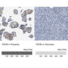 Anti-TGFBI Antibody