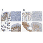 Immunohistochemical staining of human gastrointestinal, pancreas, placenta and skin using Anti-TGFBI antibody HPA017019 (A) shows similar protein distribution across tissues to independent antibody HPA008612 (B).