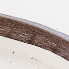 Immunohistochemical staining of human eye shows moderate extracellular 
 positivity in cornea.