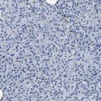 Immunohistochemical staining of human pancreas shows no positivity in exocrine glandular cells as expected.
