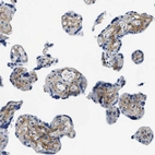 Immunohistochemical staining of human placenta shows moderate positivity 
 in extracellular matrix of trophoblastic cells.
